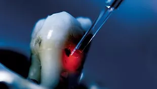 ENDODONCIA
